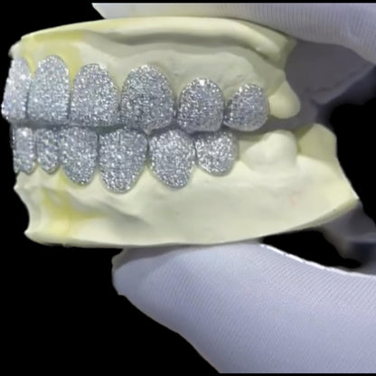 Custom Fit Grillz (SOLID, MOISSANITE, OR DIAMOND)